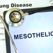 What is Mesothelioma