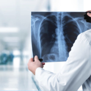 Black Lung Disease Claims - Bailey Javins & Carter