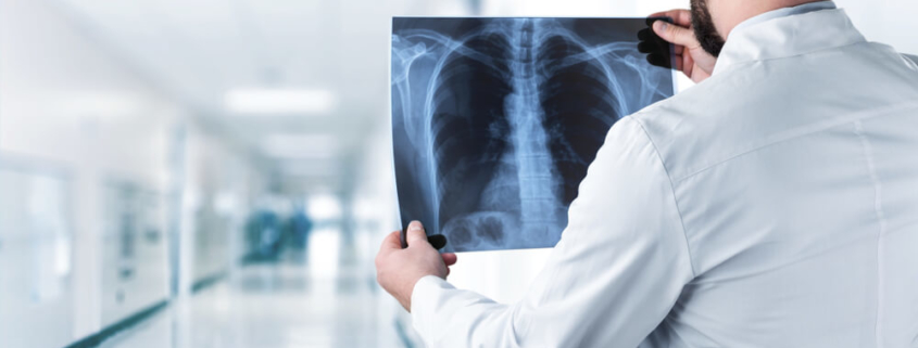 Black Lung Disease Claims - Bailey Javins & Carter